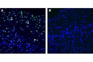Expression of NPTX2 in mouse cortex.
