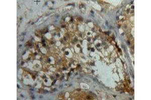 IHC-P analysis of testis tissue, with DAB staining. (LEFTY2 Antikörper  (AA 245-356))