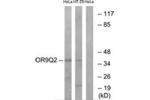 Western blot analysis of extracts from HeLa/HT-29 cells, using OR9Q2 Antibody.