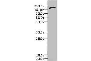 Western blot All lanes: GRIN2D antibody IgG at 3. (GRIN2D Antikörper  (AA 330-480))
