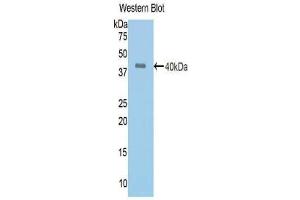 Western blot analysis of the recombinant protein. (Angiotensin I Converting Enzyme 1 Antikörper  (AA 504-597))