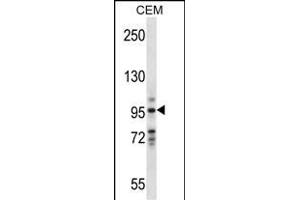 VAV1 Antibody (Center) (ABIN657774 and ABIN2846749) western blot analysis in CEM cell line lysates (35 μg/lane).