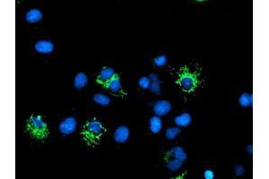 Anti-DLD mouse monoclonal antibody (ABIN2454923) immunofluorescent staining of COS7 cells transiently transfected by pCMV6-ENTRY DLD (RC200639). (DLD Antikörper)