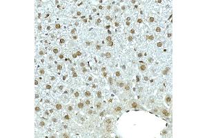 Immunohistochemistry of paraffin-embedded mouse liver using NOP10 Rabbit mAb (ABIN7268953) at dilution of 1:50 (40x lens). (Nop10 Antikörper)