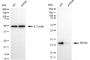 Western blotting analysis using RHOA antibody (ABIN7800142). (Rekombinanter RHOA Antikörper)