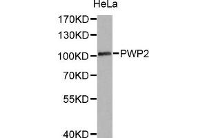 Western Blotting (WB) image for anti-PWP2 (Periodic Tryptophan Protein) Homolog (PWP2H) antibody (ABIN1876958) (PWP2 Antikörper)