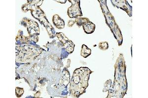 IHC analysis of CD93 using anti-CD93 antibody (ABIN7602865).