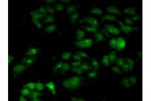 Detection of CAPN1 in Human Hela Cells using Polyclonal Antibody to Calpain 1 (CAPN1) (CAPN1 Antikörper)