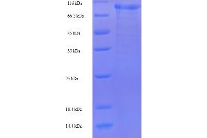 SDS-PAGE (SDS) image for Mannan-Binding Lectin Serine Peptidase 1 (MASP1) (AA 20-699) protein (His-SUMO Tag) (ABIN5709915) (MASP1 Protein (AA 20-699) (His-SUMO Tag))