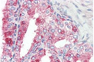 Human Prostate (formalin-fixed, paraffin-embedded) stained with GPR27 antibody ABIN410771 followed by biotinylated goat anti-rabbit IgG secondary antibody ABIN481713, alkaline phosphatase-streptavidin and chromogen. (GPR27 Antikörper  (Internal Region))