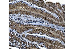 IHC analysis of MCM4 using anti-MCM4 antibody (ABIN7601485). (MCM4 Antikörper  (AA 361-677))