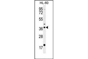 Western blot analysis of OR2W3 Antibody (C-term) in HL-60 cell line lysates (35ug/lane). (OR2W3 Antikörper  (C-Term))