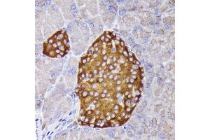 Immunohistochemistry (IHC) image for anti-Synaptophysin (SYP) (AA 150-250) antibody (ABIN6148783)