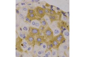 Immunohistochemistry of paraffin-embedded human liver, using NBR1 antibody (ABIN5972123). (NBR1 Antikörper)