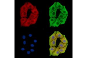 ABIN7096440 and ABIN7100504 staining Hela cells by IF/ICC. (SPG7 Antikörper)