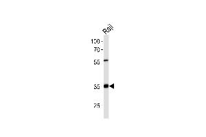 Western blot analysis of lysate from Raji cell line,using ACOT8 Antibody (ABIN6241571). (ACOT8 Antikörper)