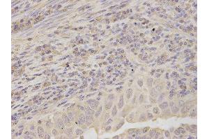 Immunohistochemistry (IHC) image for anti-Ribosomal Protein, Large, P0 (RPLP0) antibody (ABIN1876737) (RPLP0 Antikörper)
