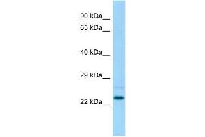 Host: Rabbit Target Name: Nsg1 Sample Type: Rat Testis lysates Antibody Dilution: 1. (NSG1 Antikörper  (N-Term))