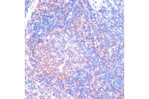 Immunohistochemistry of paraffin-embedded mouse spleen using RPS6K antibody (ABIN7270037) at dilution of 1:100 (40x lens). (RPS6KA2 Antikörper  (AA 632-733))
