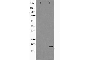 Western blot analysis on HuvEc cell lysate using TP53I11 Antibody. (TP53I11 Antikörper  (N-Term))