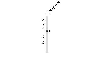 FGG Antibody (C-term) (ABIN391494 and ABIN2841461) western blot analysis in human blood plasma cell line lysates (35 μg/lane).