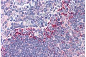 Human Thymus (formalin-fixed, paraffin-embedded) stained with TLR6 antibody ABIN214529 at 5 ug/ml followed by biotinylated goat anti-rabbit IgG secondary antibody ABIN481713, alkaline phosphatase-streptavidin and chromogen. (TLR6 Antikörper  (Internal Region))
