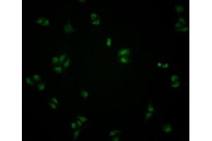 Immunofluorescence staining of Hela cells with ABIN7148805 at 1:100, counter-stained with DAPI. (ATF6 Antikörper  (AA 1-194))