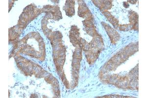 Immunohistochemistry (IHC) image for anti-CD47 (CD47) (AA 18-135) antibody (ABIN6941215)
