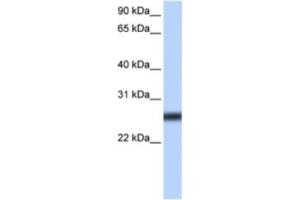 Western Blotting (WB) image for anti-Transmembrane Protease, serine 5 (TMPRSS5) antibody (ABIN2463308) (TMPRSS5 Antikörper)