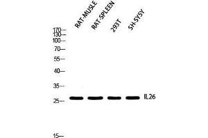 Western Blot (WB) analysis of Rat Muscle Rat SPLEEN 293T SH-SY5Y using IL26 antibody. (IL-26 Antikörper)