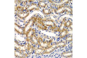 Immunohistochemistry of paraffin-embedded mouse kidney using ZF antibody (ABIN6130814, ABIN6150426, ABIN6150427 and ABIN6223369) at dilution of 1:100 (40x lens). (ZFAND3 Antikörper  (AA 1-227))