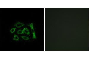 Immunofluorescence analysis of A549 cells, using ERD22 antibody. (KDELR2 Antikörper)