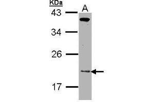 WB Image Sample (30 ug of whole cell lysate) A: Molt-4 , 12% SDS PAGE antibody diluted at 1:1000 (ZNHIT1 Antikörper)