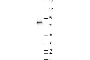 NCAPH2 antibody (mAb) (Clone 5F2G4) tested by Western blot. (NCAPH2 Antikörper)