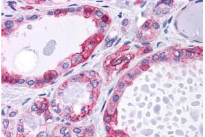 Human Thyroid: Formalin-Fixed, Paraffin-Embedded (FFPE) (CTNNB1 Antikörper)