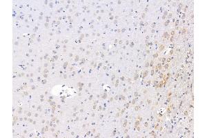 ABIN7094610 and ABIN7098660 at 1/100 staining Rat brain tissue by IHC-P. (FKBP3 Antikörper  (Internal Region))