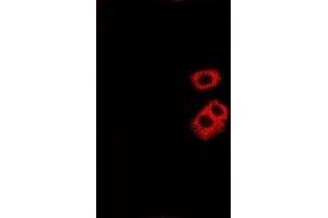 Immunofluorescent analysis of Tryptase alpha/beta staining in Hela cells. (TPSAB1 Antikörper)