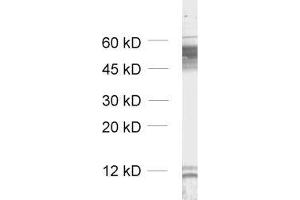 dilution: 1 : 1000, sample: unboiled synaptic membrane fraction of rat brain (LP1)