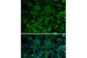 Immunofluorescence analysis of HeLa cells using CDK7 Polyclonal Antibody (CDK7 Antikörper)