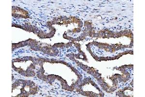 IHC analysis of HSD17B7 using anti-HSD17B7 antibody (ABIN7600174). (HSD17B7 Antikörper  (AA 16-336))