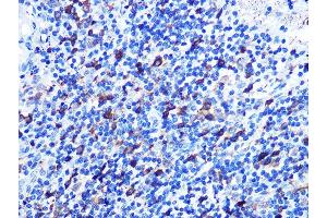 Immunohistochemistry of paraffin-embedded human appendix using Stathmin 1 Rabbit mAb (ABIN1678518, ABIN3018873, ABIN3018874 and ABIN7101680) at dilution of 1:100 (40x lens).