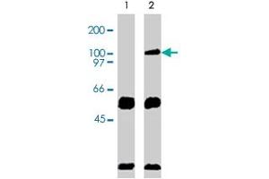 Immunoprecipation results using Western blot analysis. (VAV2 Antikörper  (AA 578-878))