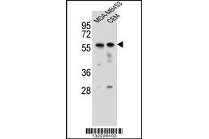 Western blot analysis in MDA-MB453,CEM cell line lysates (35ug/lane). (FOXD4 Antikörper  (AA 182-210))