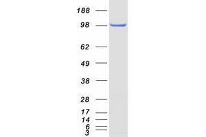 Western Blotting (WB) image for erythrocyte Membrane Protein Band 4.1-Like 1 (EPB41L1) (Transcript Variant 2) protein (Myc-DYKDDDDK Tag) (ABIN2720221)
