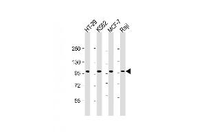 All lanes : Anti-TPX2 Antibody at 1:2000 dilution Lane 1: HT-29 whole cell lysate Lane 2: K562 whole cell lysate Lane 3: MCF-7 whole cell lysate Lane 4: Raji whole cell lysate Lysates/proteins at 20 μg per lane. (TPX2 Antikörper  (AA 1-531))