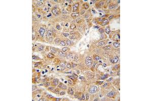Immunohistochemistry (Paraffin-embedded Sections) (IHC (p)) image for anti-Phosphoglycerate Kinase 1 (PGK1) (AA 117-145) antibody (ABIN391135)