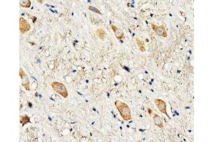 IHC-P: Dopamine Receptor D3 antibody testing of rat brain tissue (DRD3 Antikörper  (C-Term))