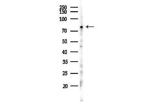 Western blot analysis of lysates from 293 cells(UV,30 min treatment), using PLO Antibody at 1/1000 dilution.