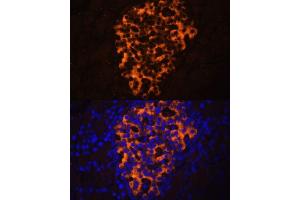 Immunofluorescence analysis of rat pancreas using PNLIPRP2 antibody (ABIN6130643, ABIN6145842, ABIN6145843 and ABIN6216695) at dilution of 1:100. (PNLIPRP2 Antikörper  (AA 301-470))