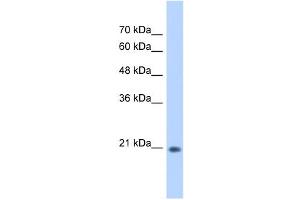 WB Suggested Anti-GINS2 Antibody Titration:  0. (GINS2 Antikörper  (C-Term))